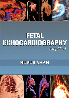 Fötale Echokardiographie - Vereinfacht - Fetal Echocardiography - Simplified