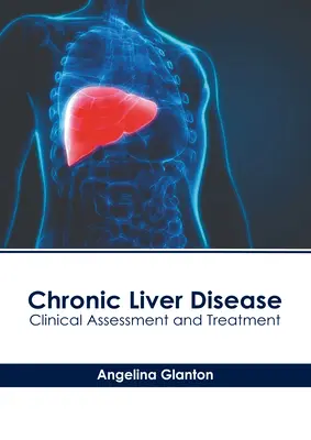 Chronische Lebererkrankung: Klinische Beurteilung und Behandlung - Chronic Liver Disease: Clinical Assessment and Treatment