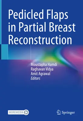 Gestielte Lappen bei der partiellen Brustrekonstruktion - Pedicled Flaps in Partial Breast Reconstruction