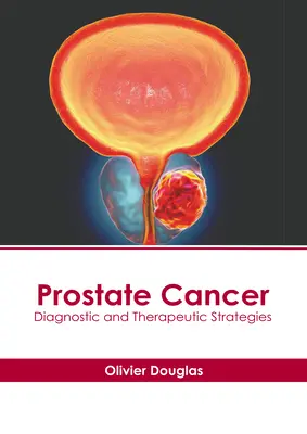 Prostatakrebs: Diagnostische und therapeutische Strategien - Prostate Cancer: Diagnostic and Therapeutic Strategies