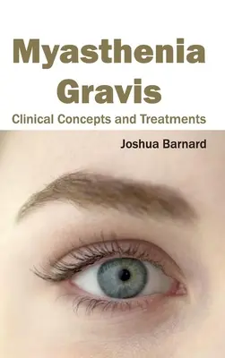 Myasthenia Gravis: Klinische Konzepte und Behandlungen - Myasthenia Gravis: Clinical Concepts and Treatments
