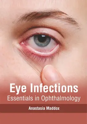 Augeninfektionen: Grundlagen der Ophthalmologie - Eye Infections: Essentials in Ophthalmology