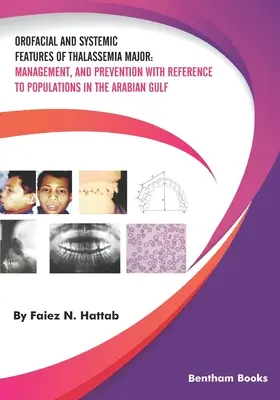 Orofaziale und systemische Merkmale der Thalassämie Major: Management und Prävention mit Bezug auf die Bevölkerung am Arabischen Golf - Orofacial and Systemic Features of Thalassemia Major: Management, and Prevention with Reference to Populations in the Arabian Gulf