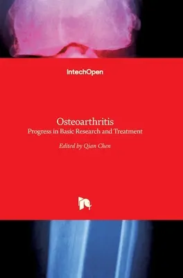 Arthrose: Fortschritte in Grundlagenforschung und Behandlung - Osteoarthritis: Progress in Basic Research and Treatment