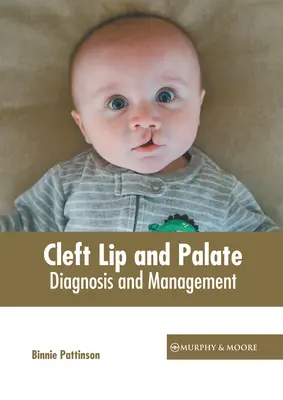 Lippen-Kiefer-Gaumenspalte: Diagnose und Management - Cleft Lip and Palate: Diagnosis and Management