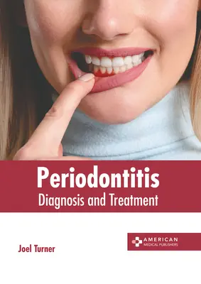 Parodontitis: Diagnose und Behandlung - Periodontitis: Diagnosis and Treatment