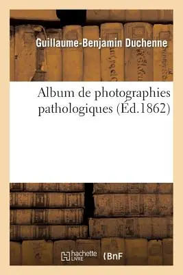 Album de Photographies Pathologiques, Complimentaire Du Livre Intitul de l'lectrisation Localise - Album de Photographies Pathologiques, Complmentaire Du Livre Intitul de l'lectrisation Localise