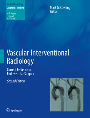 Vaskuläre Interventionelle Radiologie: Aktuelle Evidenz in der endovaskulären Chirurgie - Vascular Interventional Radiology: Current Evidence in Endovascular Surgery