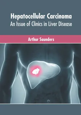 Hepatozelluläres Karzinom: Eine Ausgabe von Clinics in Liver Disease - Hepatocellular Carcinoma: An Issue of Clinics in Liver Disease