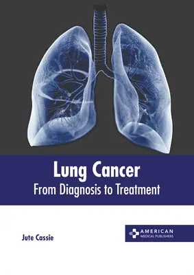 Lungenkrebs: Von der Diagnose zur Behandlung - Lung Cancer: From Diagnosis to Treatment