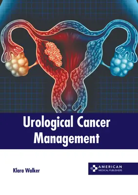 Urologisches Krebsmanagement - Urological Cancer Management