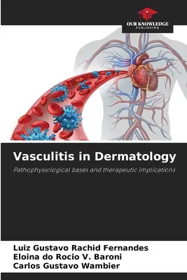 Vaskulitis in der Dermatologie - Vasculitis in Dermatology