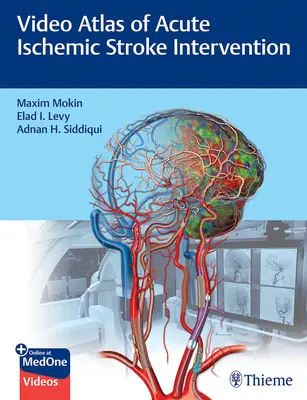 Videoatlas der Intervention bei akutem ischämischem Schlaganfall - Video Atlas of Acute Ischemic Stroke Intervention