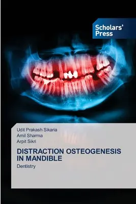 Distraktionsosteogenese im Unterkiefer - Distraction Osteogenesis in Mandible