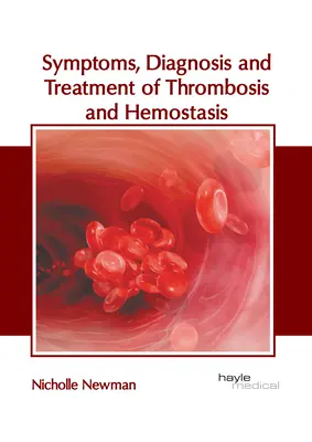 Symptome, Diagnose und Behandlung von Thrombose und Hämostase - Symptoms, Diagnosis and Treatment of Thrombosis and Hemostasis