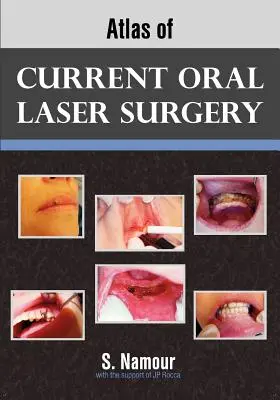 Atlas der aktuellen oralen Laserchirurgie - Atlas of Current Oral Laser Surgery