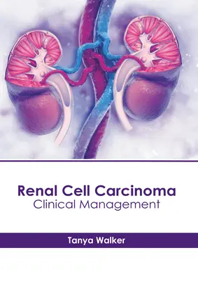 Nierenzellkarzinom: Klinisches Management - Renal Cell Carcinoma: Clinical Management