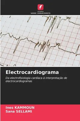 Elektrokardiogramm - Electrocardiograma