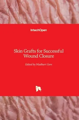 Hauttransplantationen für den erfolgreichen Wundverschluss - Skin Grafts for Successful Wound Closure