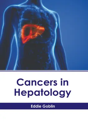 Krebserkrankungen in der Hepatologie - Cancers in Hepatology