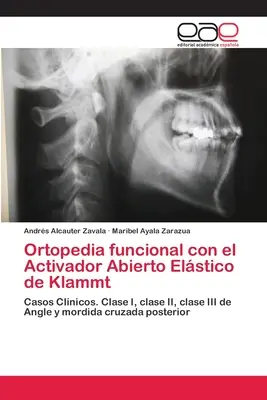 Ortopedia funcional mit dem Activador Abierto Elstico von Klammt - Ortopedia funcional con el Activador Abierto Elstico de Klammt