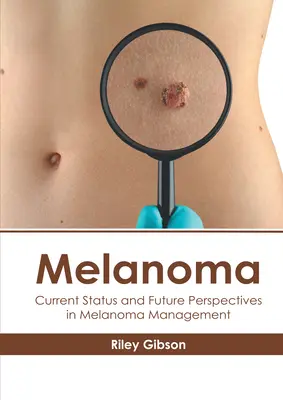 Melanom: Aktueller Stand und Zukunftsperspektiven der Melanombehandlung - Melanoma: Current Status and Future Perspectives in Melanoma Management