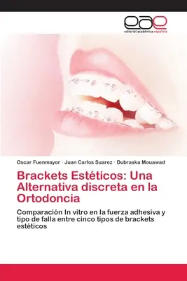 Klammern Estticos: Eine diskrete Alternative in der Ortodontie - Brackets Estticos: Una Alternativa discreta en la Ortodoncia