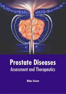 Prostata-Erkrankungen: Beurteilung und Therapie - Prostate Diseases: Assessment and Therapeutics