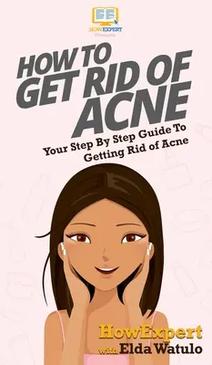 Wie man Akne loswird: Ihr schrittweiser Leitfaden zum Loswerden von Akne - How To Get Rid of Acne: Your Step By Step Guide To Getting Rid of Acne