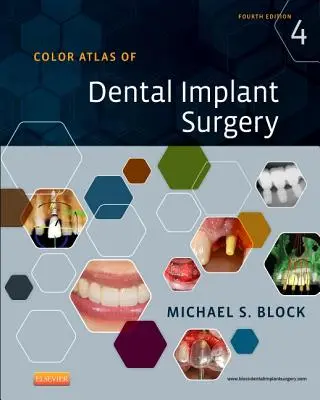 Farbatlas der zahnärztlichen Implantatchirurgie - Color Atlas of Dental Implant Surgery