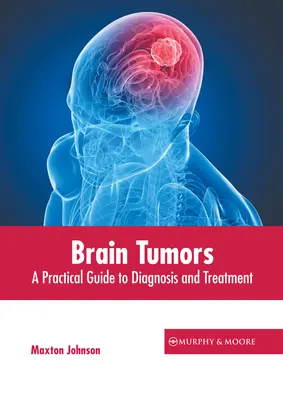 Hirntumore: Ein praktischer Leitfaden für Diagnose und Behandlung - Brain Tumors: A Practical Guide to Diagnosis and Treatment