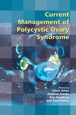 Aktuelles Management des Syndroms der polyzystischen Eierstöcke - Current Management of Polycystic Ovary Syndrome