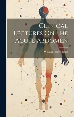 Klinische Vorlesungen über das akute Abdomen - Clinical Lectures On The Acute Abdomen