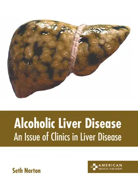 Alkoholische Lebererkrankung: Eine Ausgabe von Clinics in Liver Disease - Alcoholic Liver Disease: An Issue of Clinics in Liver Disease