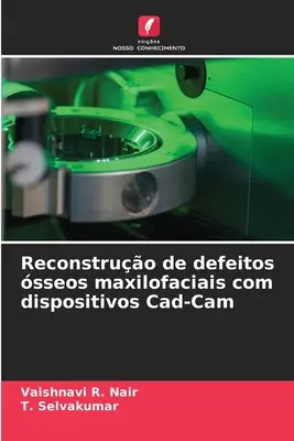 Reconstruo de defeitos sseos maxilofaciais com dispositivos Cad-Cam