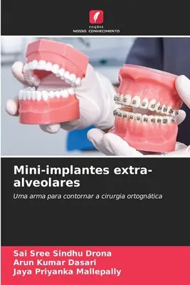 Mini-Implantate extra-alveolares - Mini-implantes extra-alveolares