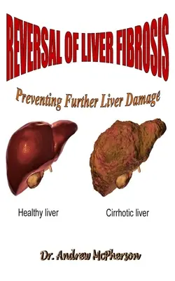 Umkehrung der Leberfibrose: Vorbeugung weiterer Leberschäden - Reversal of Liver Fibrosis: Preventing Further Liver Damage