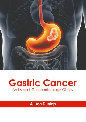 Magenkrebs: Eine Ausgabe von Gastroenterology Clinics - Gastric Cancer: An Issue of Gastroenterology Clinics