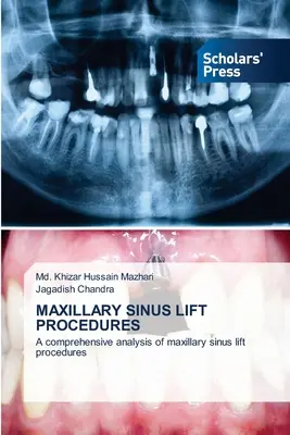 Kieferhöhlenlift-Verfahren - Maxillary Sinus Lift Procedures