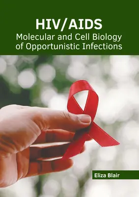 Hiv/Aids: Molekular- und Zellbiologie der opportunistischen Infektionen - Hiv/Aids: Molecular and Cell Biology of Opportunistic Infections