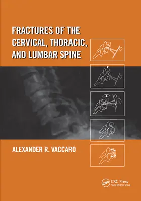Frakturen der Hals-, Brust- und Lendenwirbelsäule - Fractures of the Cervical, Thoracic, and Lumbar Spine