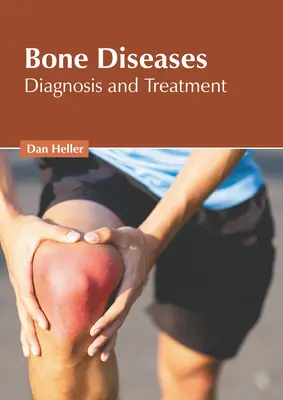 Knochenkrankheiten: Diagnose und Behandlung - Bone Diseases: Diagnosis and Treatment