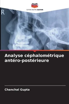 Analyse von Gehirnströmen in der Nachkriegszeit - Analyse cphalomtrique antro-postrieure