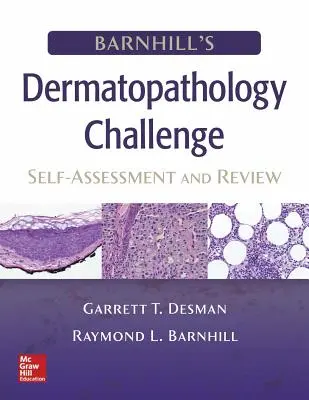 Barnhill's Dermatopathology Challenge: Selbsteinschätzung und Überprüfung - Barnhill's Dermatopathology Challenge: Self-Assessment & Review