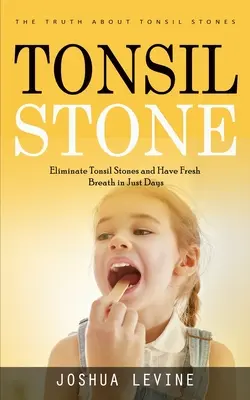 Mandelentzündungen: Die Wahrheit über Mandelentzündungen (Beseitigen Sie Mandelentzündungen und haben Sie frischen Atem in nur wenigen Tagen!) - Tonsil Stones: The Truth about Tonsil Stones (Eliminate Tonsil Stones and Have Fresh Breath in Just Days!)