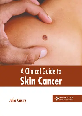 Ein klinischer Leitfaden für Hautkrebs - A Clinical Guide to Skin Cancer