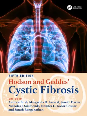 Hodson und Geddes' Mukoviszidose - Hodson and Geddes' Cystic Fibrosis