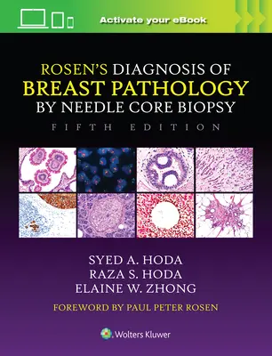 Rosen's Diagnostik der Brustpathologie durch Nadelkernbiopsie - Rosen's Diagnosis of Breast Pathology by Needle Core Biopsy