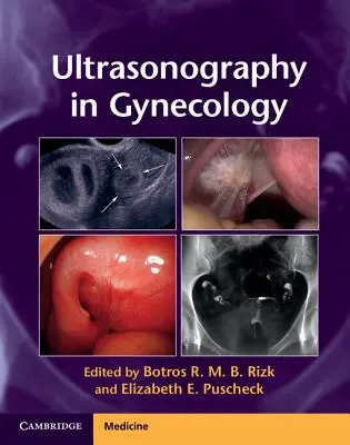 Ultraschalluntersuchung in der Gynäkologie - Ultrasonography in Gynecology