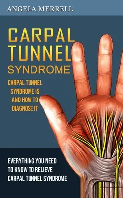 Karpaltunnel-Syndrom: Was das Karpaltunnelsyndrom ist und wie man es diagnostiziert - Carpal Tunnel Syndrome: Carpal Tunnel Syndrome is and How to Diagnose It